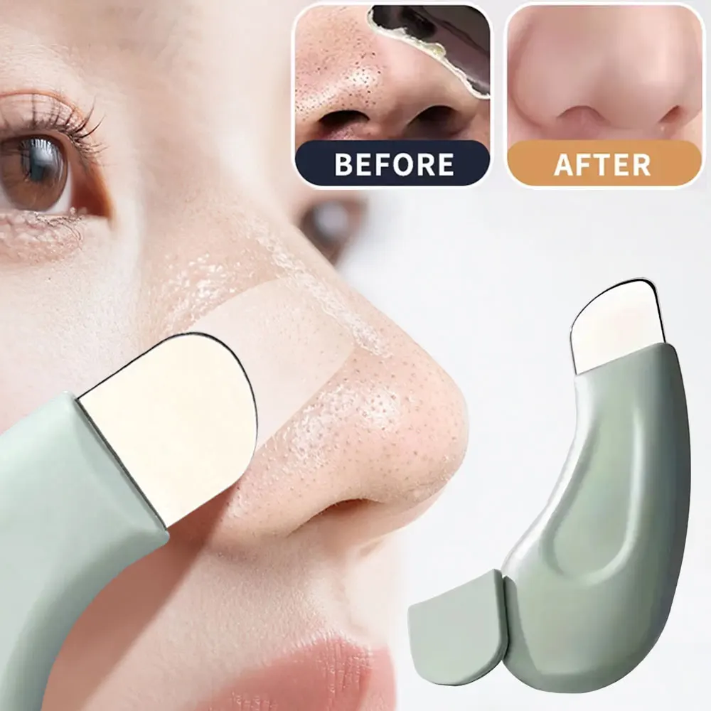 أداة إزالة الرؤوس السوداء من ا - مراجعة Nasal Aspirator وسعره